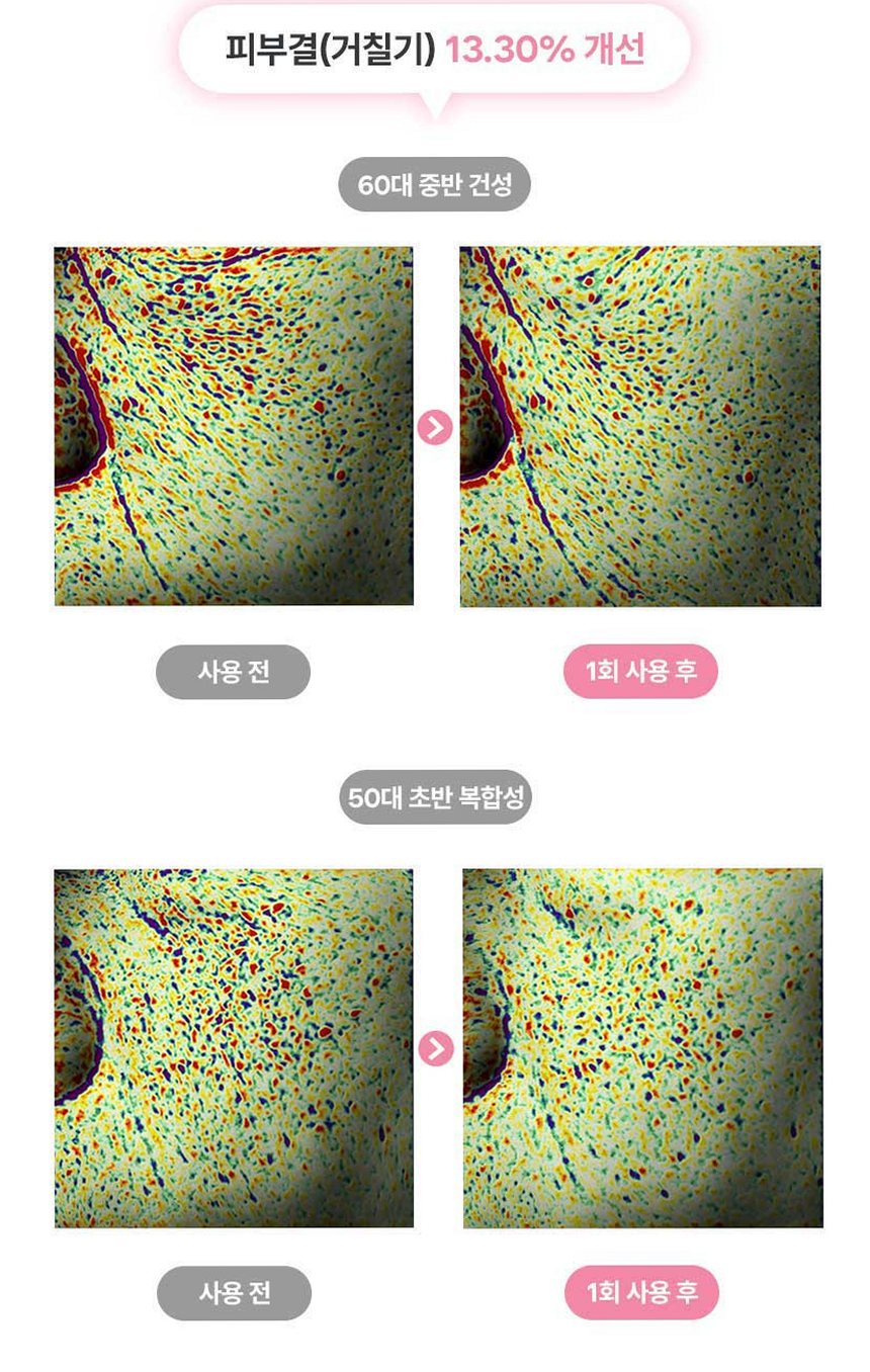 펄리 엑소좀 피부과재생크림 수분 보습 시카 히알루론산 물광크림 40ml, 1개